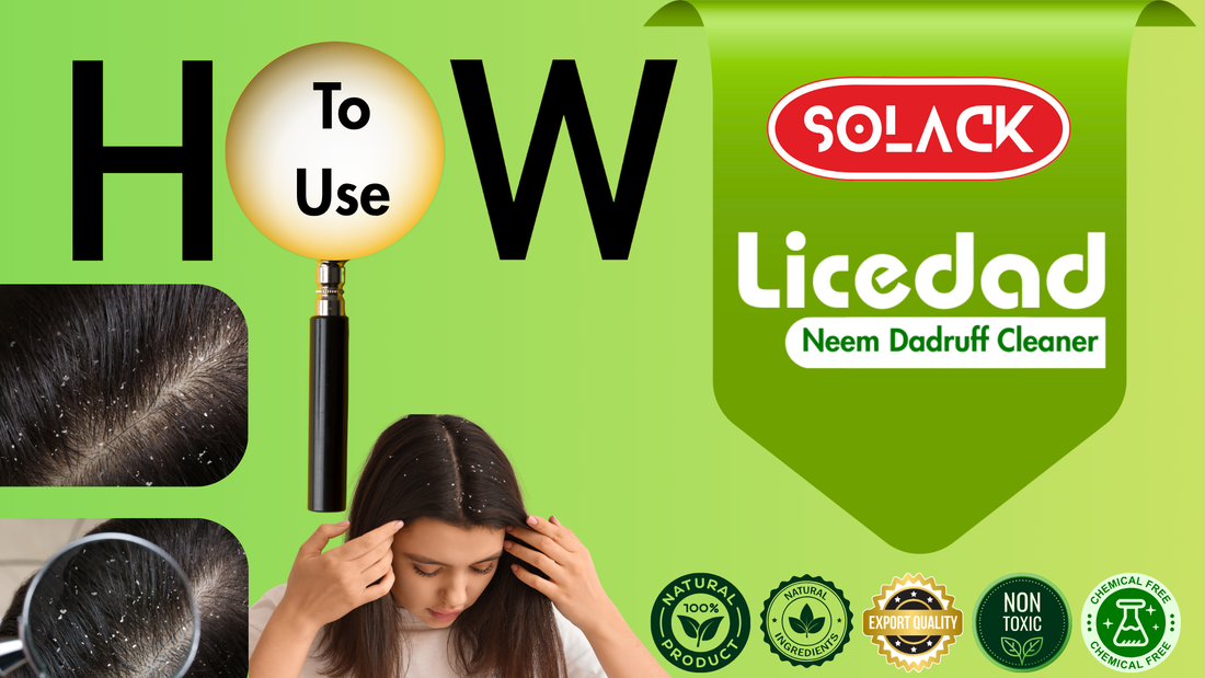 Banish Lice and Dandruff Naturally: